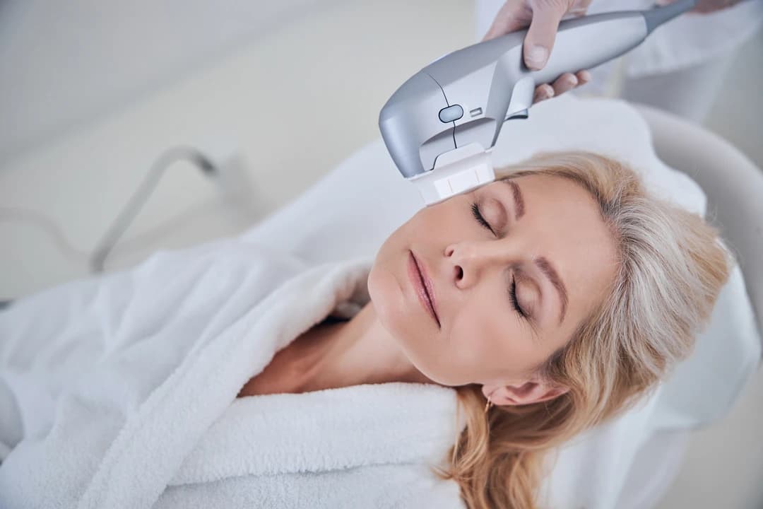 IPL Photofacial